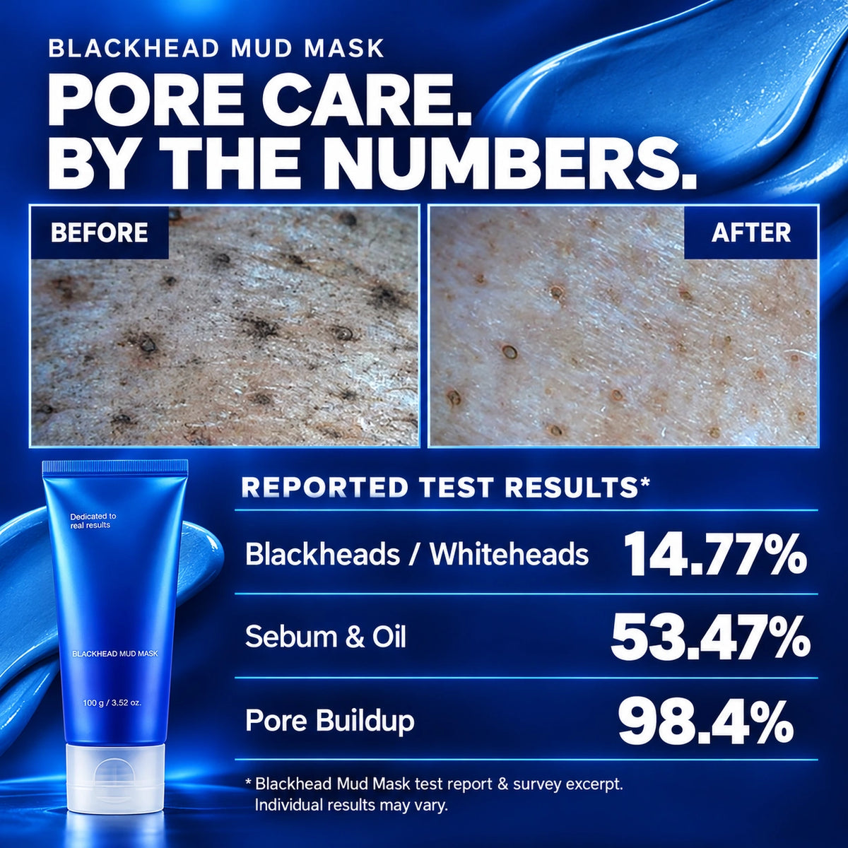 Zero Pores Blackhead Mud Mask-Free Pore Brush